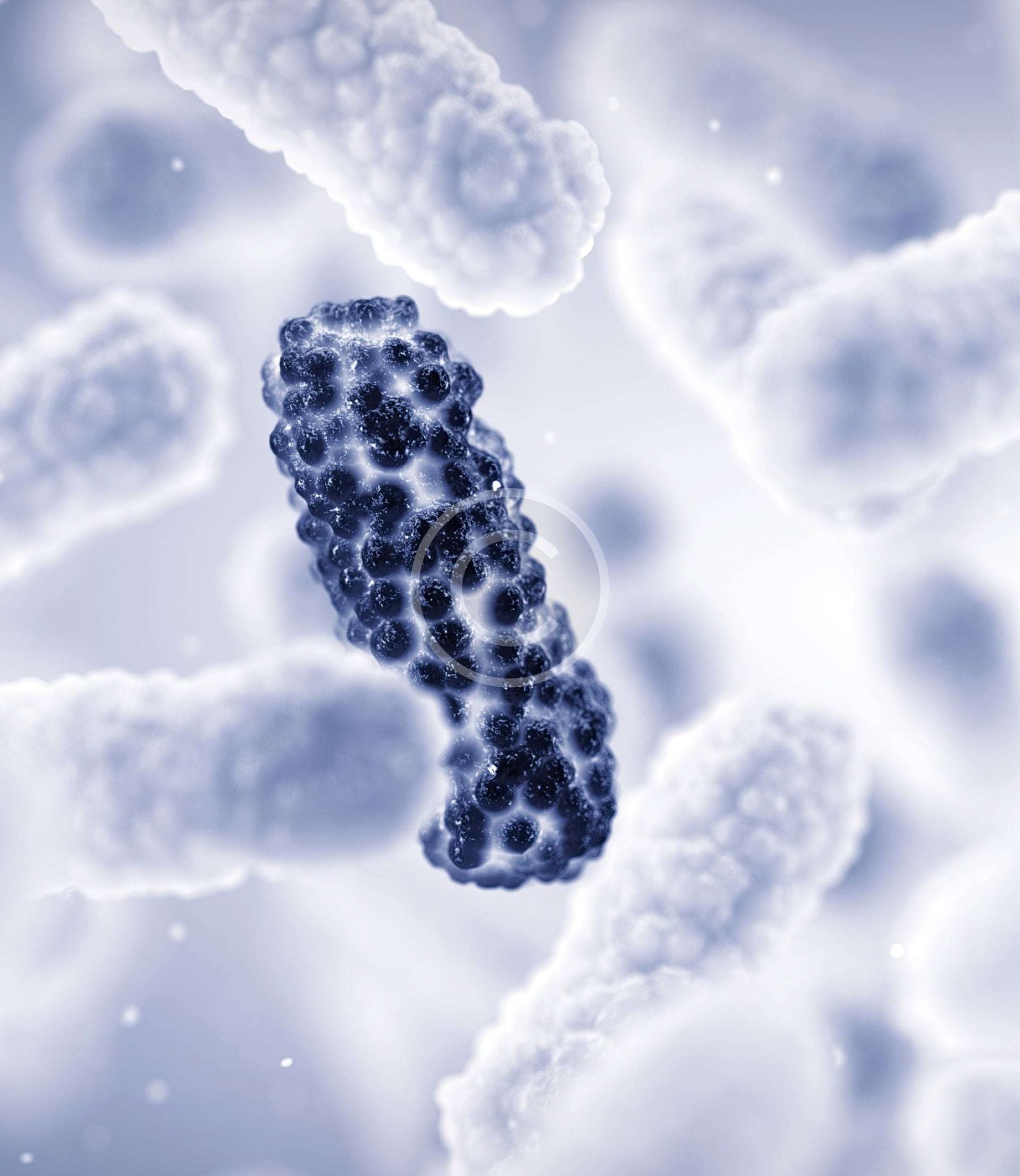 Forte dépendance à des examens lourds